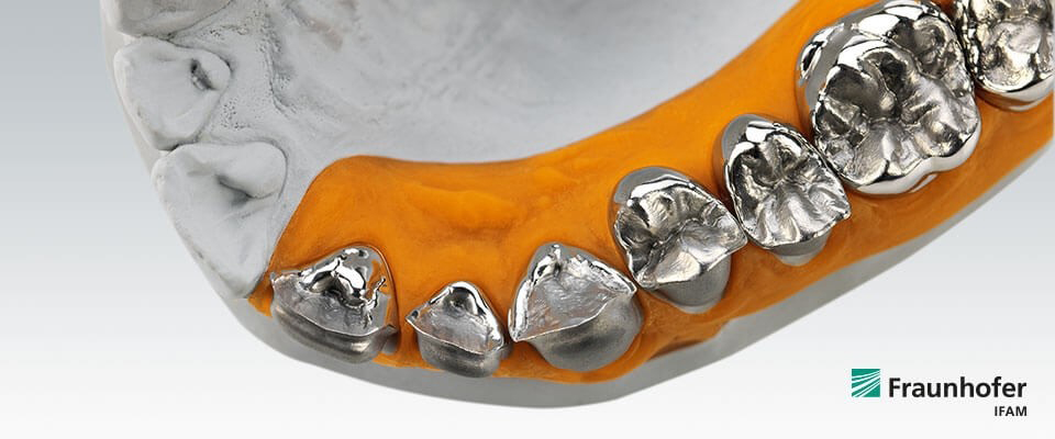 Modell eines Dentalimplantats mit Ceramill Sintron®