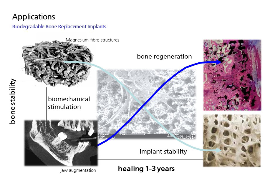 Overview of Biodegradable Implant Materials