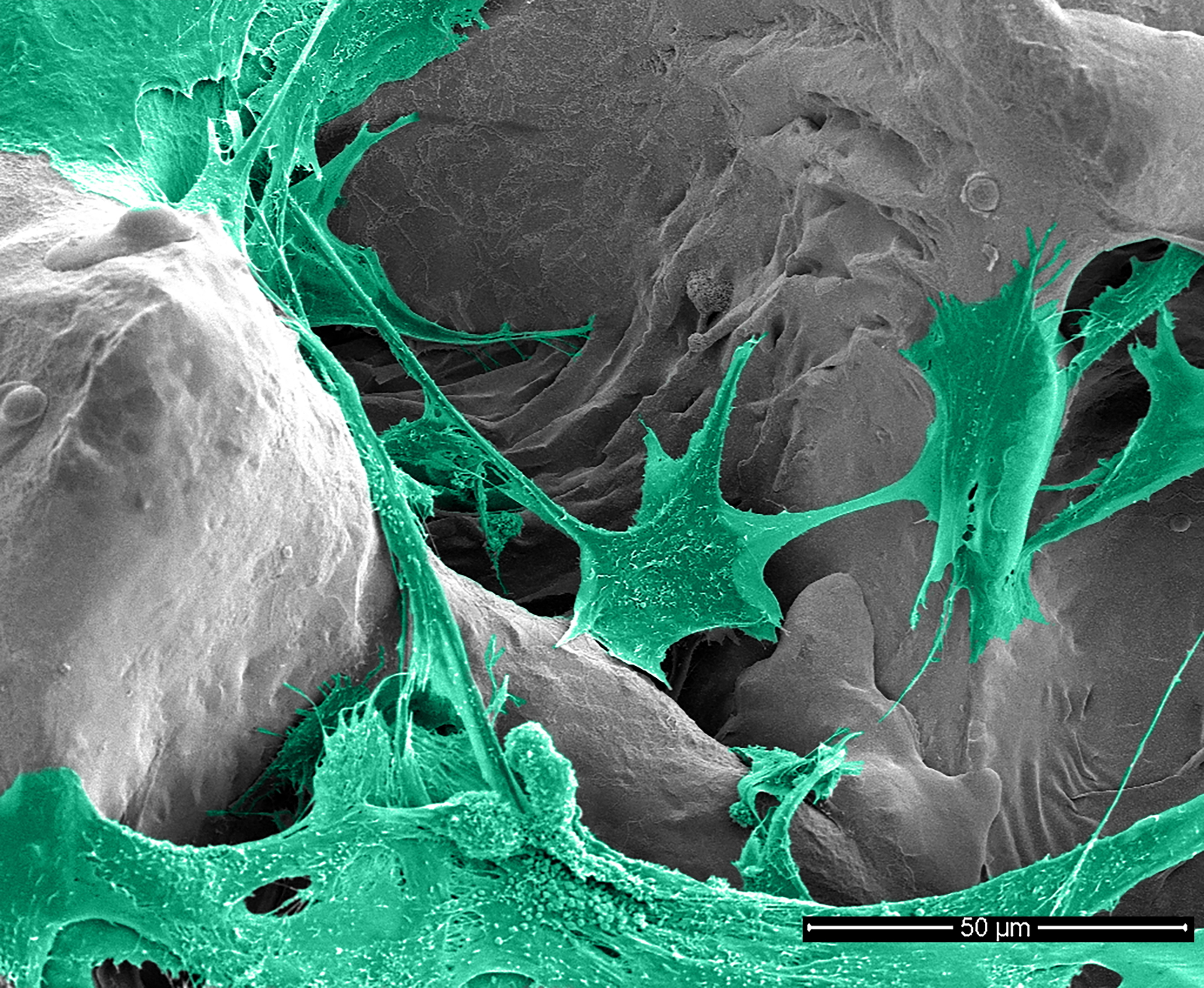 Electron micro-scope image of osteoblast-like cells (MG-63) on the hybrid coating.