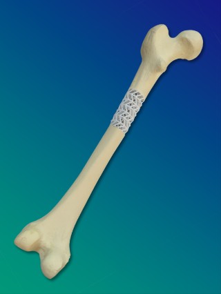 Scaffold in a long bone